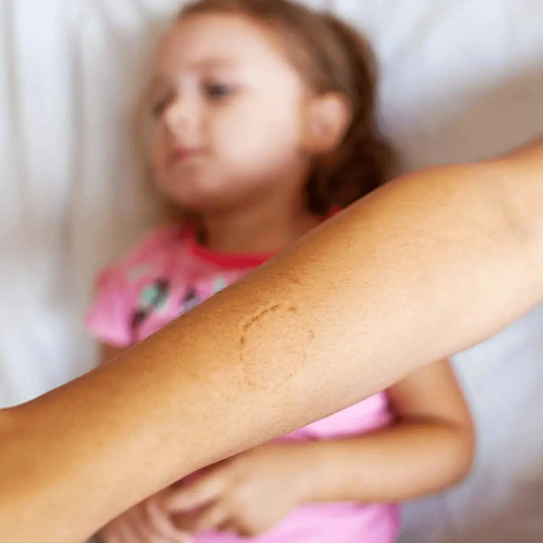 How We Respond to Biting Incidents in School